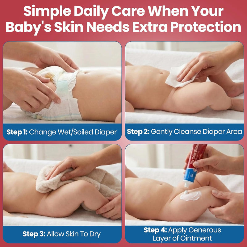 Zinc Oxide Ointment for Adults and Babies - 1 oz Diaper Rash Ointment - Skin Protectant for Diaper Rashes, Cuts, and Burns